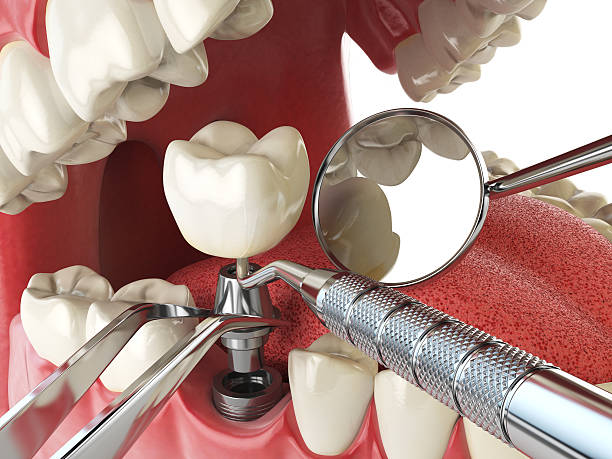 Best Emergency Orthodontic Repairs in Bloomfield, IA